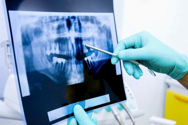 Рентгенологическое исследование позволяет стоматологу решить несколько задач