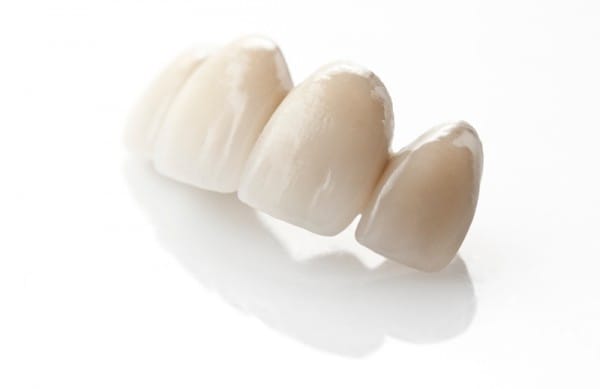 И зубные коронки, выполненные из оксида циркония, и металлокерамические, и металлопластмассовые искусственные зубы имеют превосходные эстетические характеристики