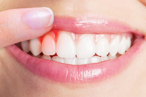 Лечение десен зубов