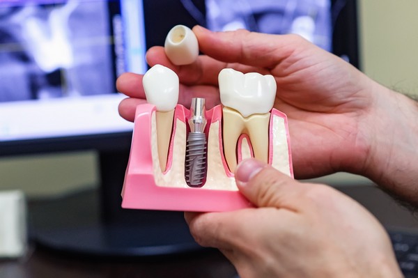 Методы лечения зубов