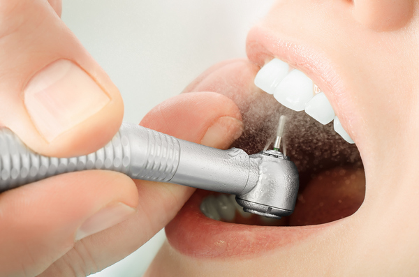 Как протекает лечение кариеса передних зубов