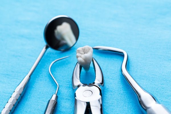 Удаление зубов – крайняя мера, на которую в клинике профессорской стоматологии “22 век” решаются в случаях, когда на 100 % уверены, что другие лечебные процедуры не принесут желаемого результата или бессмысленны