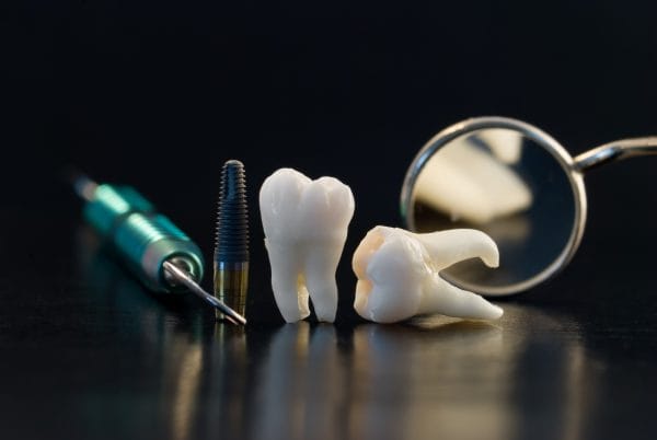 Удаление зуба мудрости без боли – это не миф
