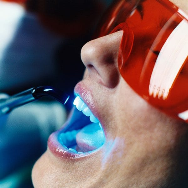 Лазерное отбеливание зубов – популярная стоматологическая процедура, которая многим людям позволяет стать более открытыми