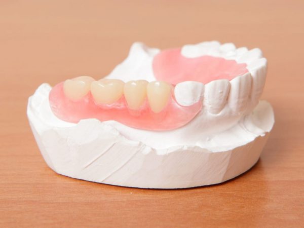 Научными исследованиями в стоматологии было показано, что процессы регенерации костной ткани и заживления лунки под непосредственным пластиночным иммедиат-протезом протекают значительно быстрее.