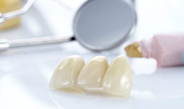 Пластмассовые мостовидные зубные протезы