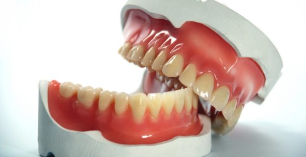 Протезирование зубов в стоматологии 