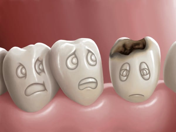 Нарушен обмен веществ в организме, в результате чего зубы недополучают необходимые минеральные вещества