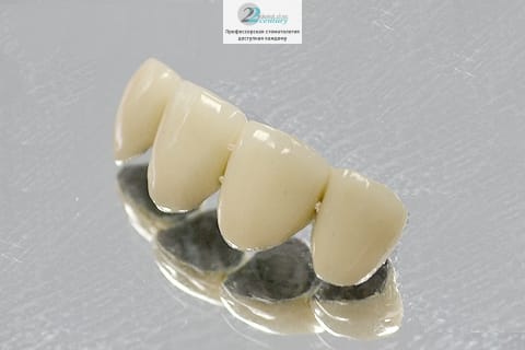 Очень распространенный материал для протезирования зубов