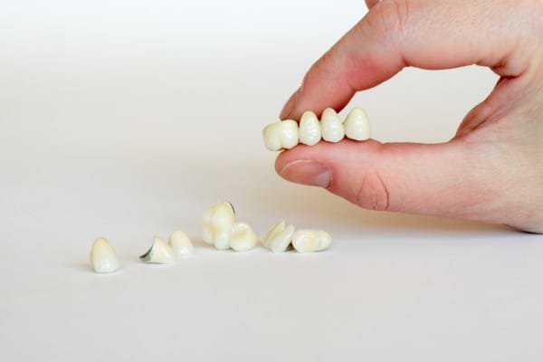 Искусственные коронки зубов визуально практически неотличимы от настоящих зубов. Форма, величина, цвет каждой коронки подбирается строго индивидуально